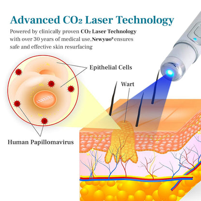 Newyuo® LumeSkin Mole and Wart Removal Laser Pen